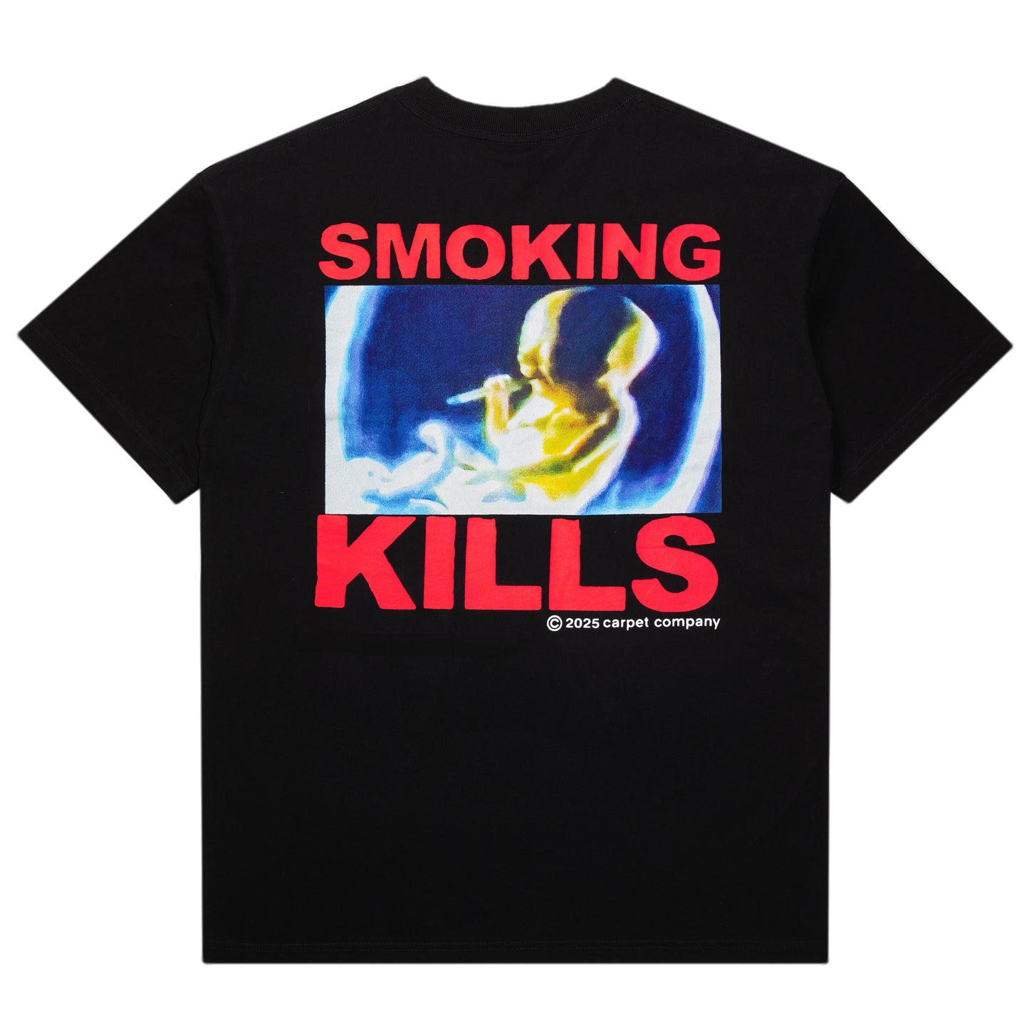 Carpet Company Smoking Kills Tee - Black